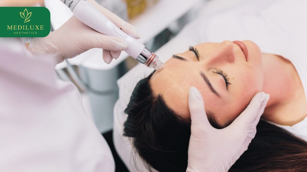 Best HydraFacial Treatment in Janakpuri