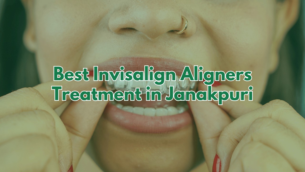 Best Invisalign Aligners Treatment in Janakpuri