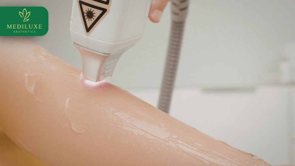 Best Laser Hair Reduction Treatment in Janakpuri