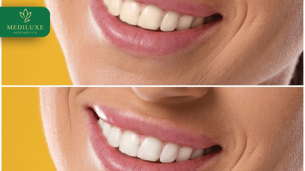Best Smile Design Treatment in Janakpuri