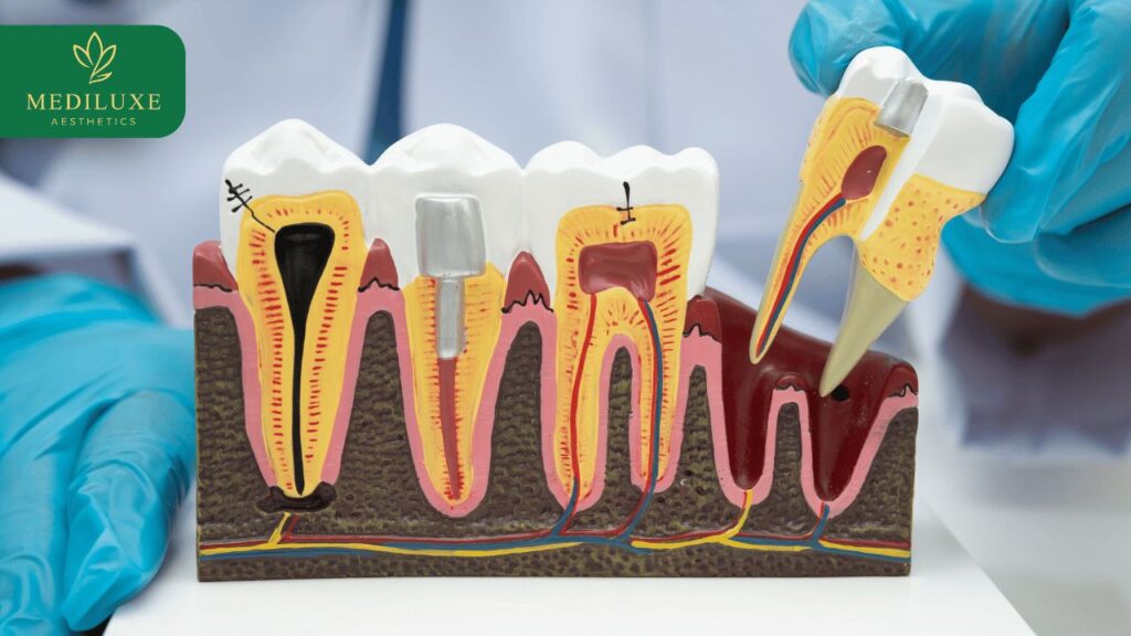 Painless Root Canal Treatment in Janakpuri
