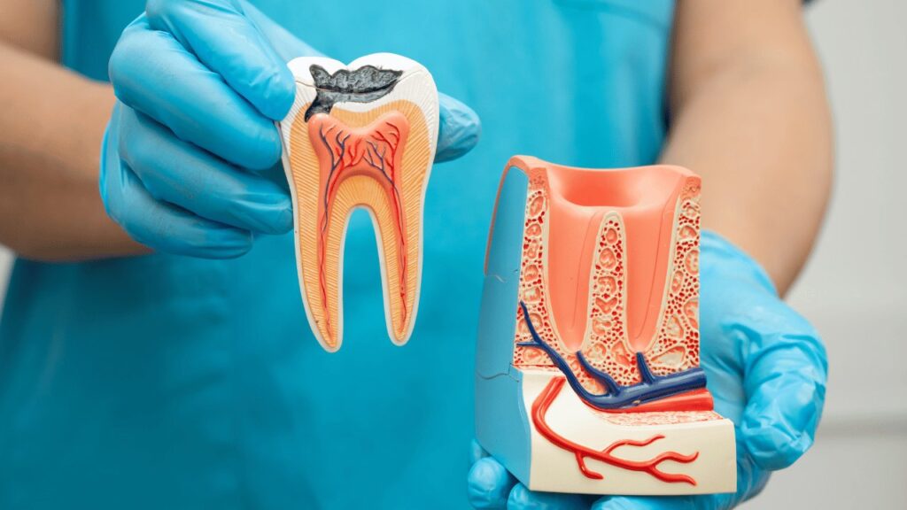Root Canal Treatment in Janakpuri