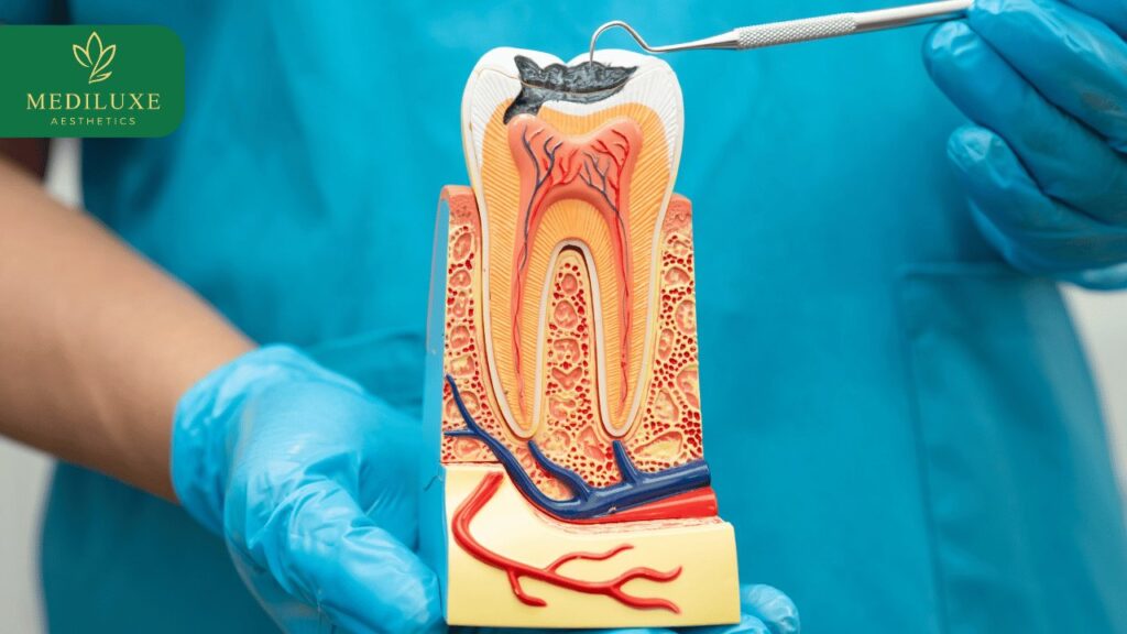 Painless Root Canal Treatment in Janakpuri