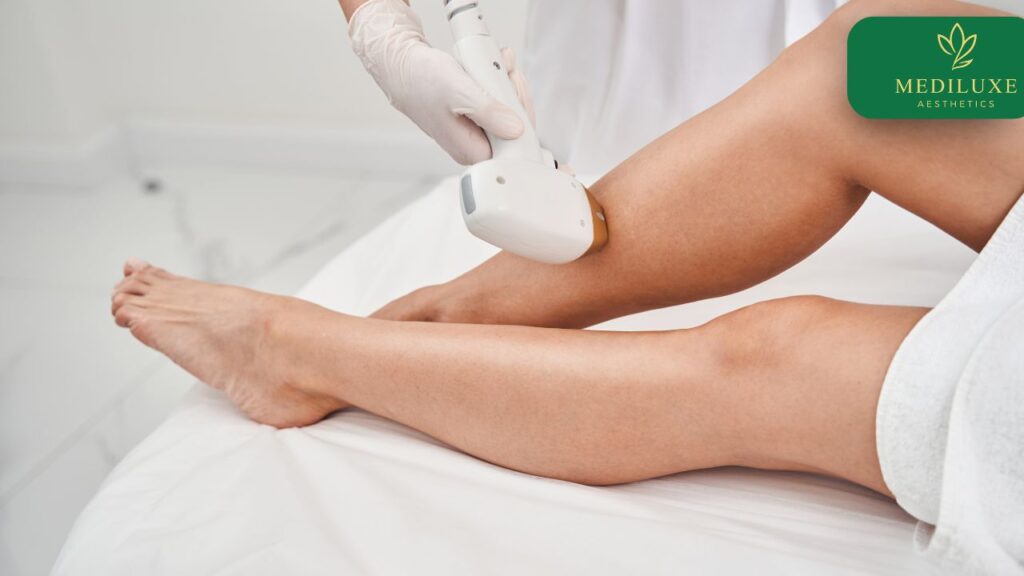 Diode laser treatment safe for Indian skin tone at Mediluxe Delhi