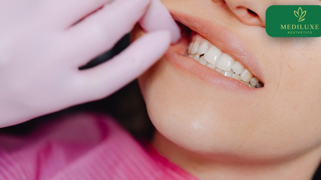 Dental crown consultation at Mediluxe in Janakpuri