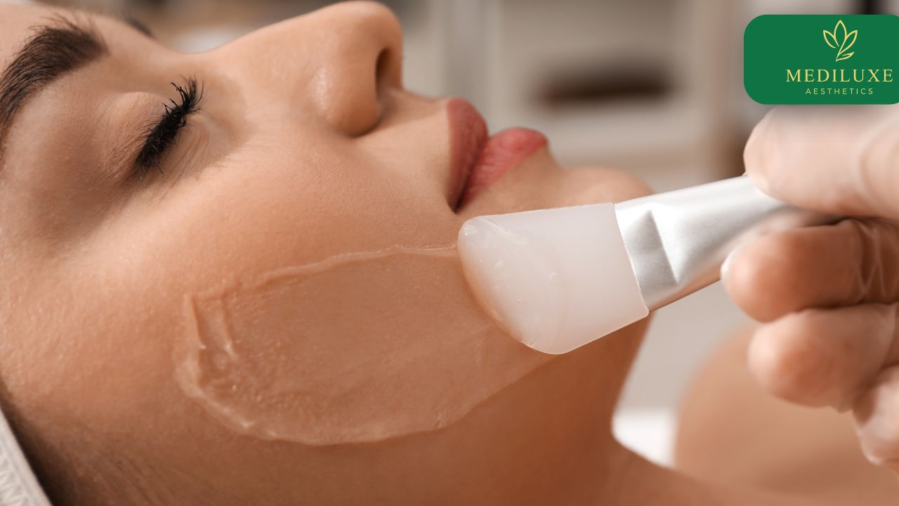 Chemical Peel Treatment in Janakpuri