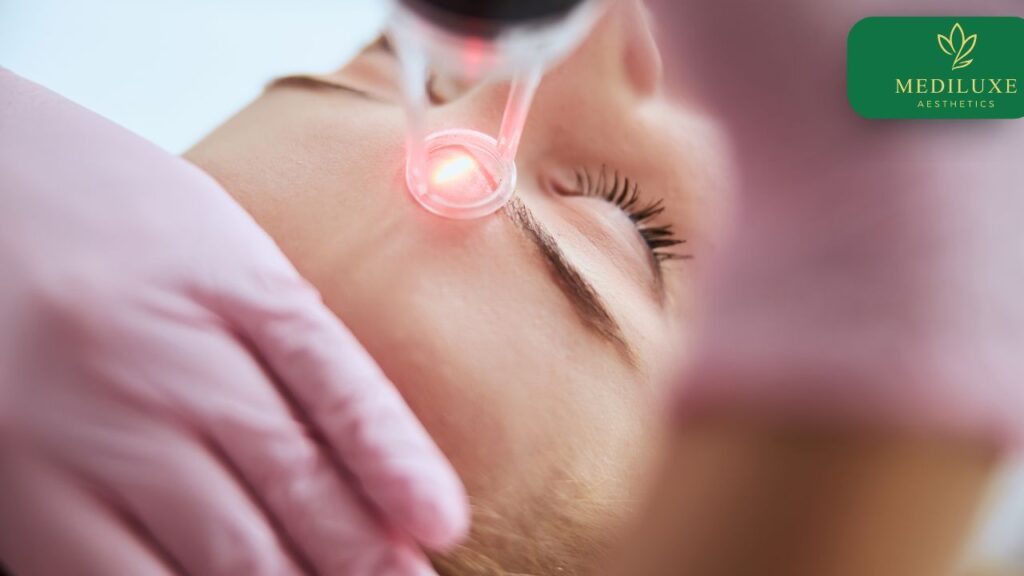 Assessing pigmentation depth before Pico Laser treatment